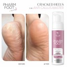 Pharm Foot - Anti Callus Master 200ml thumbnail